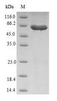 RASSF6 Protein - (Tris-Glycine gel) Discontinuous SDS-PAGE (reduced) with 5% enrichment gel and 15% separation gel.