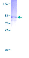 RASSF8 Protein - 12.5% SDS-PAGE of human C12orf2 stained with Coomassie Blue