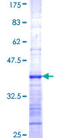 RASSF8 Protein - 12.5% SDS-PAGE Stained with Coomassie Blue.