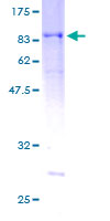 RASSF9 / P-CIP1 Protein - 12.5% SDS-PAGE of human PAMCI stained with Coomassie Blue