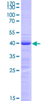 RAX / RX Protein - 12.5% SDS-PAGE Stained with Coomassie Blue.
