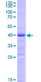 RAX / RX Protein - 12.5% SDS-PAGE Stained with Coomassie Blue.