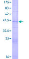 RAXL1 / RAX2 Protein - 12.5% SDS-PAGE of human MGC15631 stained with Coomassie Blue