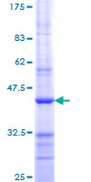 RB1 / Retinoblastoma / RB Protein - 12.5% SDS-PAGE Stained with Coomassie Blue.
