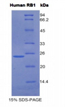 RB1 / Retinoblastoma / RB Protein - Recombinant Retinoblastoma Protein 1 By SDS-PAGE