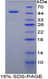 RB1 / Retinoblastoma / RB Protein - Recombinant Retinoblastoma Protein 1 By SDS-PAGE