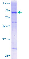 RBBP4 / RBAP48 Protein - 12.5% SDS-PAGE of human RBBP4 stained with Coomassie Blue