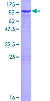 RBBP5 Protein - 12.5% SDS-PAGE of human RBBP5 stained with Coomassie Blue