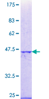 RBBP5 Protein - 12.5% SDS-PAGE Stained with Coomassie Blue.