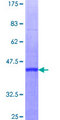 RBBP6 Protein - 12.5% SDS-PAGE of human RBBP6 stained with Coomassie Blue