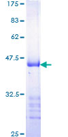 RBBP6 Protein - 12.5% SDS-PAGE Stained with Coomassie Blue.