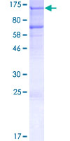 RBBP8 / CTIP Protein - 12.5% SDS-PAGE of human RBBP8 stained with Coomassie Blue