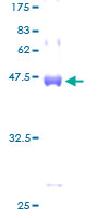 RBBP9 Protein - 12.5% SDS-PAGE of human RBBP9 stained with Coomassie Blue