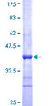 RBBP9 Protein - 12.5% SDS-PAGE Stained with Coomassie Blue.