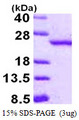 RBBP9 Protein