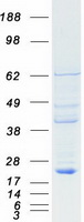RBBP9 Protein - Purified recombinant protein RBBP9 was analyzed by SDS-PAGE gel and Coomassie Blue Staining
