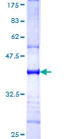 RBCK1 Protein - 12.5% SDS-PAGE Stained with Coomassie Blue.