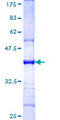 RBCK1 Protein - 12.5% SDS-PAGE Stained with Coomassie Blue.