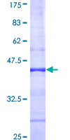 RBL1 / p107 Protein - 12.5% SDS-PAGE Stained with Coomassie Blue.