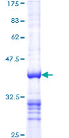 RBL2 / RB2 p130 Protein - 12.5% SDS-PAGE Stained with Coomassie Blue.