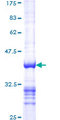 RBL2 / RB2 p130 Protein - 12.5% SDS-PAGE Stained with Coomassie Blue.