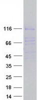 RBL2 / RB2 p130 Protein - Purified recombinant protein RBL2 was analyzed by SDS-PAGE gel and Coomassie Blue Staining