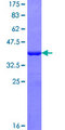 RBM10 Protein - 12.5% SDS-PAGE Stained with Coomassie Blue.