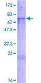 RBM11 Protein - 12.5% SDS-PAGE of human RBM11 stained with Coomassie Blue