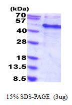 RBM13 / MAK16 Protein