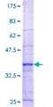 RBM15 Protein - 12.5% SDS-PAGE Stained with Coomassie Blue.