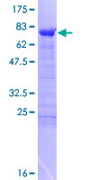 RBM17 Protein - 12.5% SDS-PAGE of human RBM17 stained with Coomassie Blue