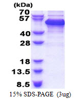 RBM17 Protein