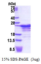 RBM18 Protein