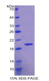 RBM20 Protein - Recombinant RNA Binding Motif Protein 20 By SDS-PAGE