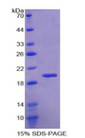 RBM20 Protein - Recombinant RNA Binding Motif Protein 20 By SDS-PAGE