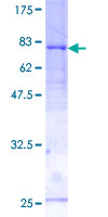 RBM22 Protein - 12.5% SDS-PAGE of human RBM22 stained with Coomassie Blue