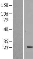 RBM24 Protein - Western validation with an anti-DDK antibody * L: Control HEK293 lysate R: Over-expression lysate