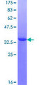 RBM3 Protein - 12.5% SDS-PAGE Stained with Coomassie Blue.