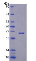 RBM3 Protein - Recombinant RNA Binding Motif Protein 3 By SDS-PAGE