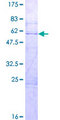 RBM38 Protein - 12.5% SDS-PAGE of human RBM38 stained with Coomassie Blue