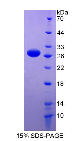 RBM38 Protein - Recombinant RNA Binding Motif Protein 38 By SDS-PAGE