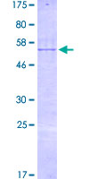 RBM40 / RNPC3 Protein - 12.5% SDS-PAGE of human RNPC3 stained with Coomassie Blue