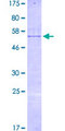 RBM40 / RNPC3 Protein - 12.5% SDS-PAGE of human RNPC3 stained with Coomassie Blue