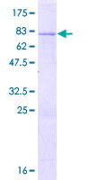 RBM41 Protein - 12.5% SDS-PAGE of human RBM41 stained with Coomassie Blue