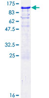 RBM5 / G15 Protein - 12.5% SDS-PAGE of human RBM5 stained with Coomassie Blue
