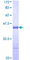 RBM5 / G15 Protein - 12.5% SDS-PAGE Stained with Coomassie Blue.