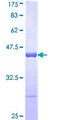 RBM5 / G15 Protein - 12.5% SDS-PAGE Stained with Coomassie Blue.