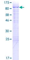 RBM6 / 3G2 Protein - 12.5% SDS-PAGE of human RBM6 stained with Coomassie Blue