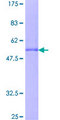 RBM7 Protein - 12.5% SDS-PAGE of human RBM7 stained with Coomassie Blue