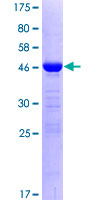 RBM8A / Y14 Protein - 12.5% SDS-PAGE of human RBM8A stained with Coomassie Blue